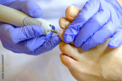 Pedicure specialist works with the patient in clinic photo