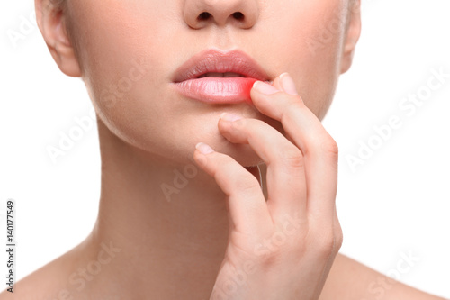 Woman with cold sore touching lips on white background
