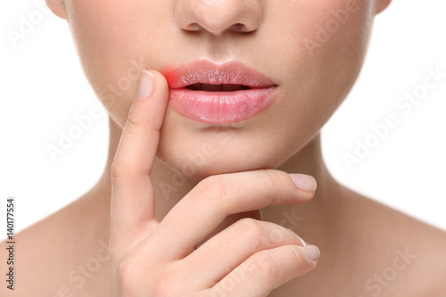 Woman with cold sore touching lips on white background
