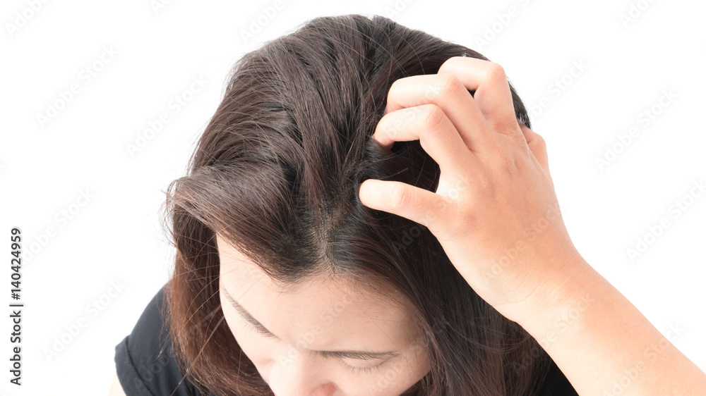 Fototapeta premium Closeup woman hand itchy scalp, Hair care concept