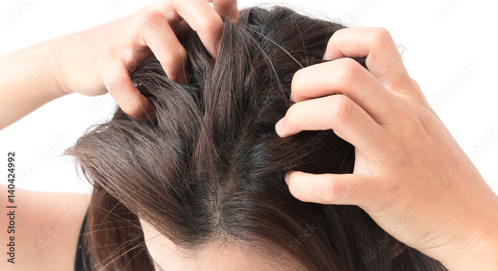 Fototapeta premium Closeup woman hand itchy scalp, Hair care concept