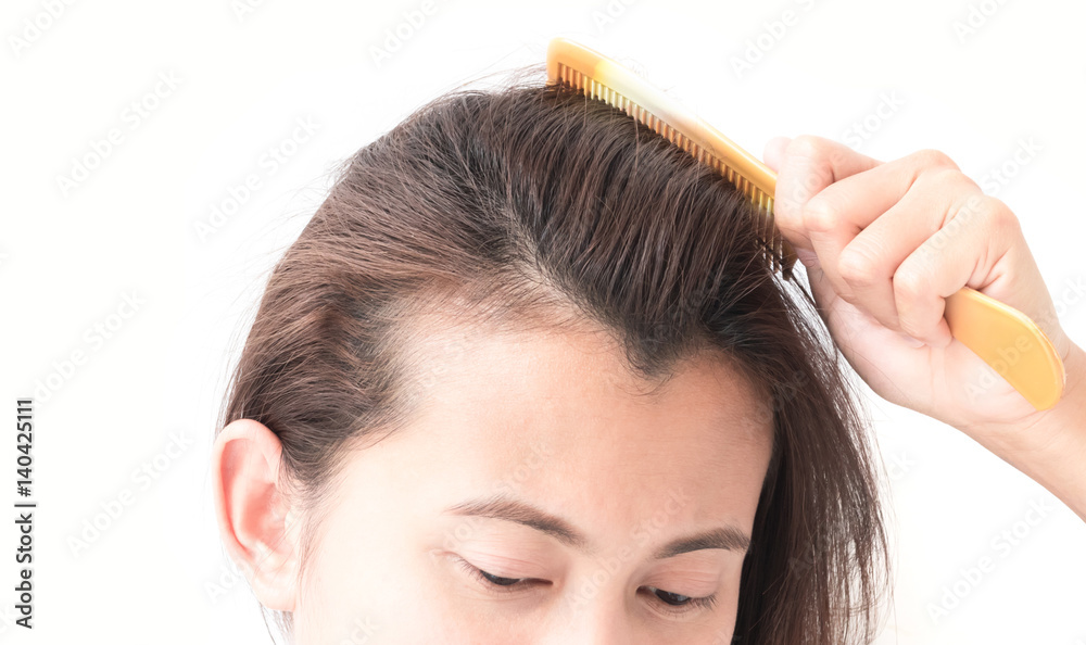Woman serious hair loss problem for health care shampoo and beauty product concept Woman serious hair loss problem for health care shampoo and beauty product concept