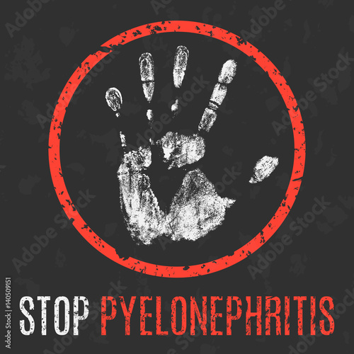 Vector illustration. Human sickness. Stop pyelonephritis.