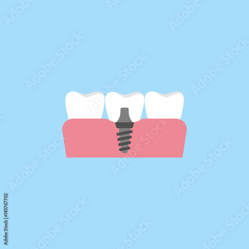 Dental implant flat icon, Dental and medicine, vector graphics, a colorful solid pattern on a blue background, eps 10.