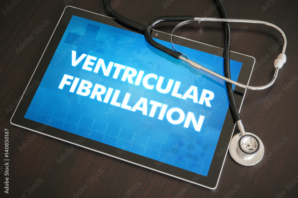 Ταπετσαρία Ventricular fibrillation (heart disorder) diagnosis medical concept on tablet sc