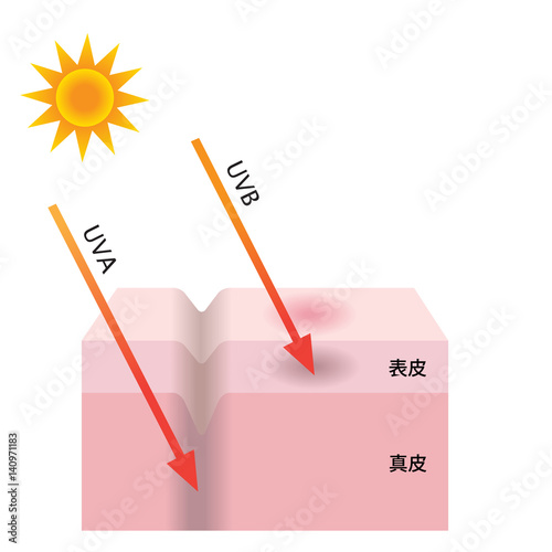 紫外線