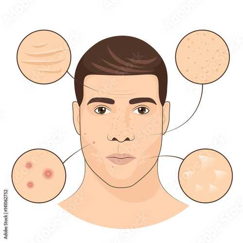 Man portrait with facial treatments. Face skin care vector illustration