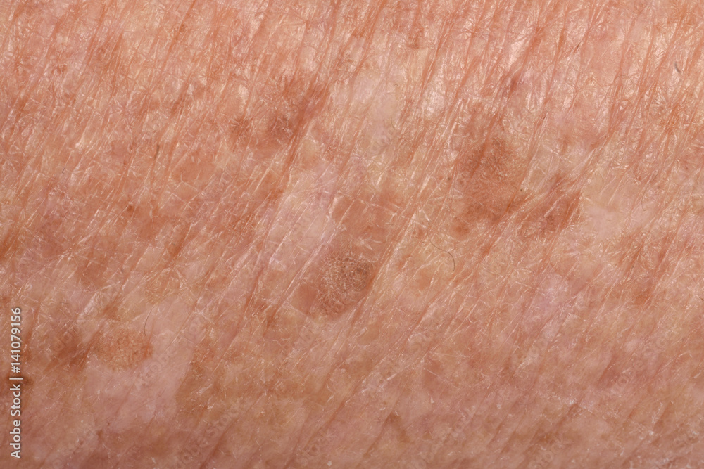 Fototapeta premium Detail of texture skin, senior woman,arm