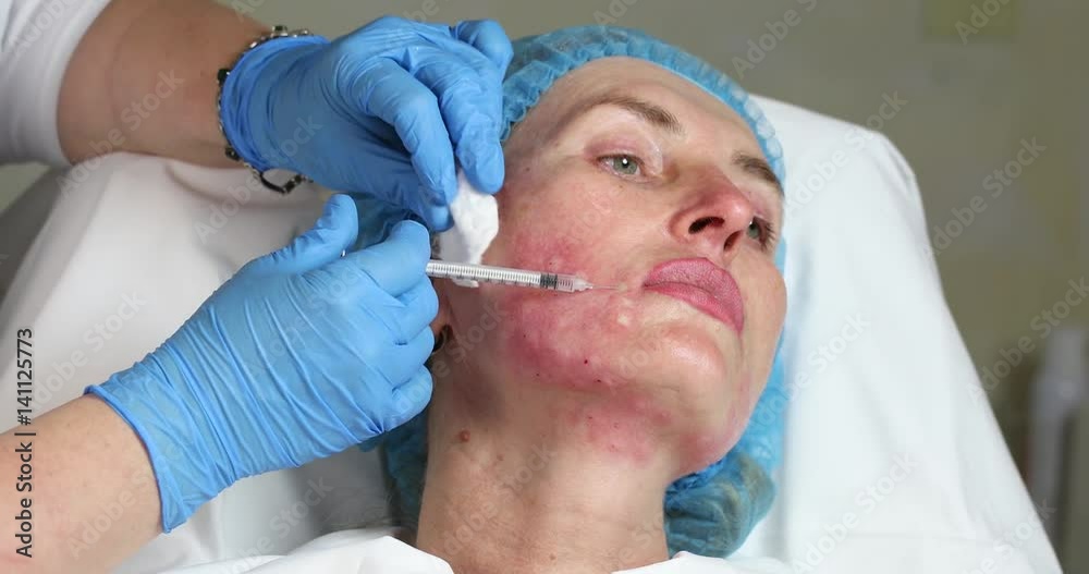 Cosmetic treatment with injection in a clinic Cosmetic treatment with injection in a clinic