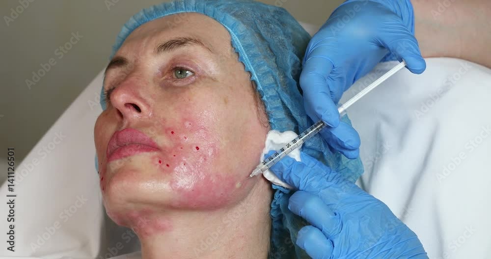 Cosmetic treatment with injection in a clinic Cosmetic treatment with injection in a clinic