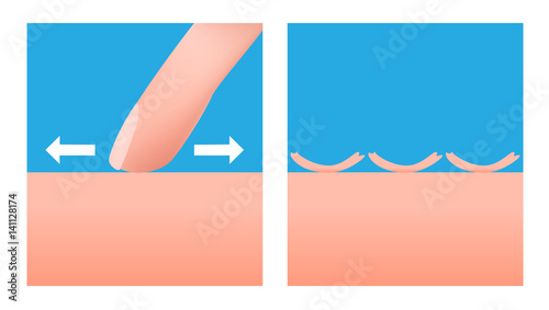 scurf and skin vector . no moisturizer 