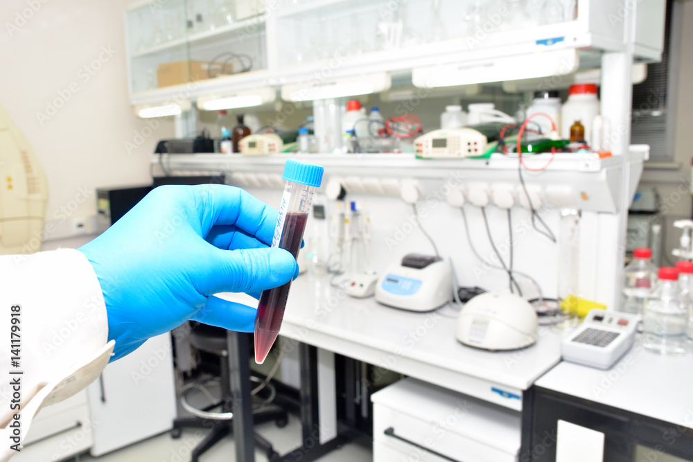 Laboratory examination of the blood. Laboratory examination of the blood.