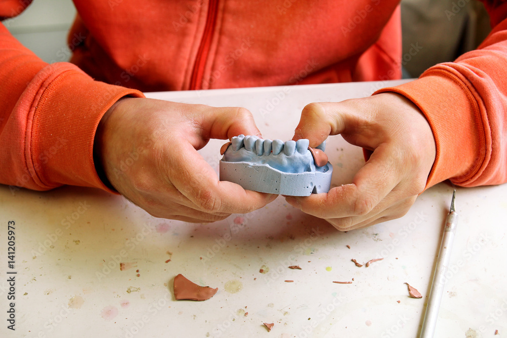 Working with Shellac base plates. Dentures. Dental prosthesis, dentures