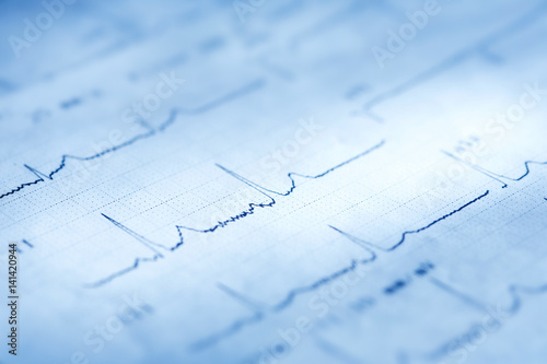 cardiogram close up