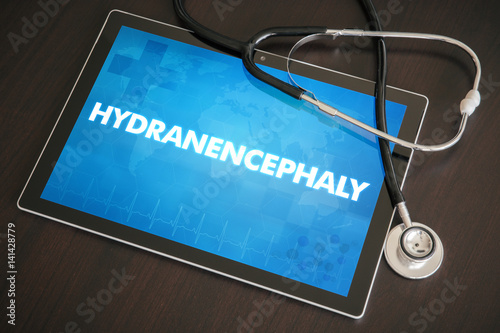 Hydranencephaly (neurological disorder) diagnosis medical concept on tablet screen with stethoscope photo