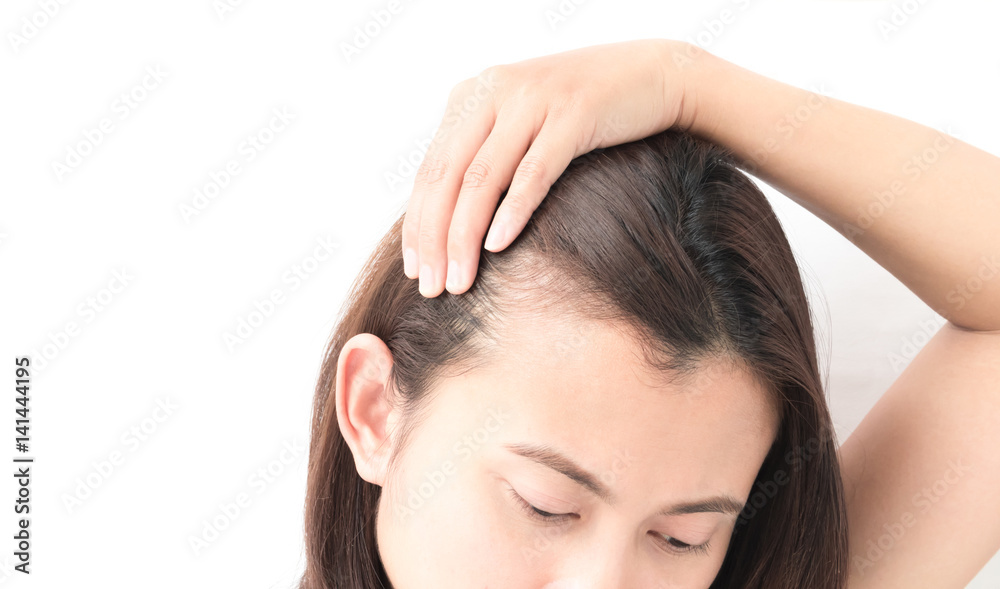 Woman serious hair loss problem for health care shampoo and beauty product concept Woman serious hair loss problem for health care shampoo and beauty product concept