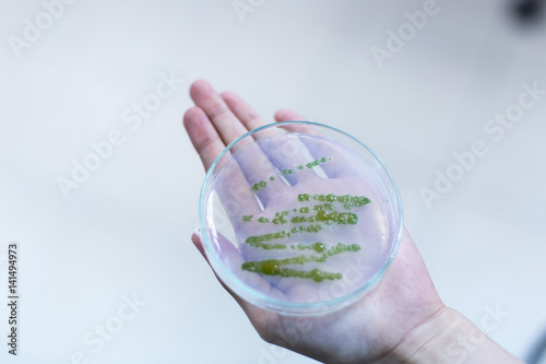 Petri dish for Phytoplankton and inoculum for culture in laboratories.