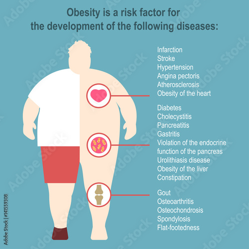 Obesity Vector illustration Poster template The effect of obesity on the health and human internal organs Medical poster in flat design photo