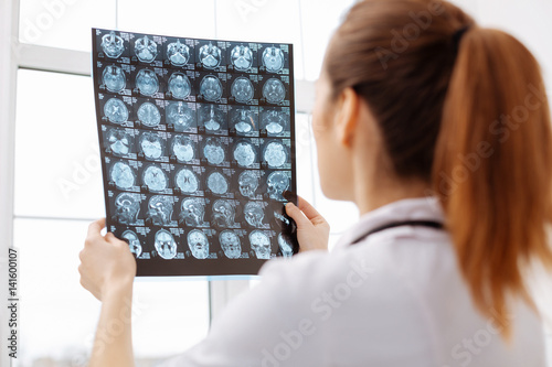 Careful excellent doctor having a better look at brain scans