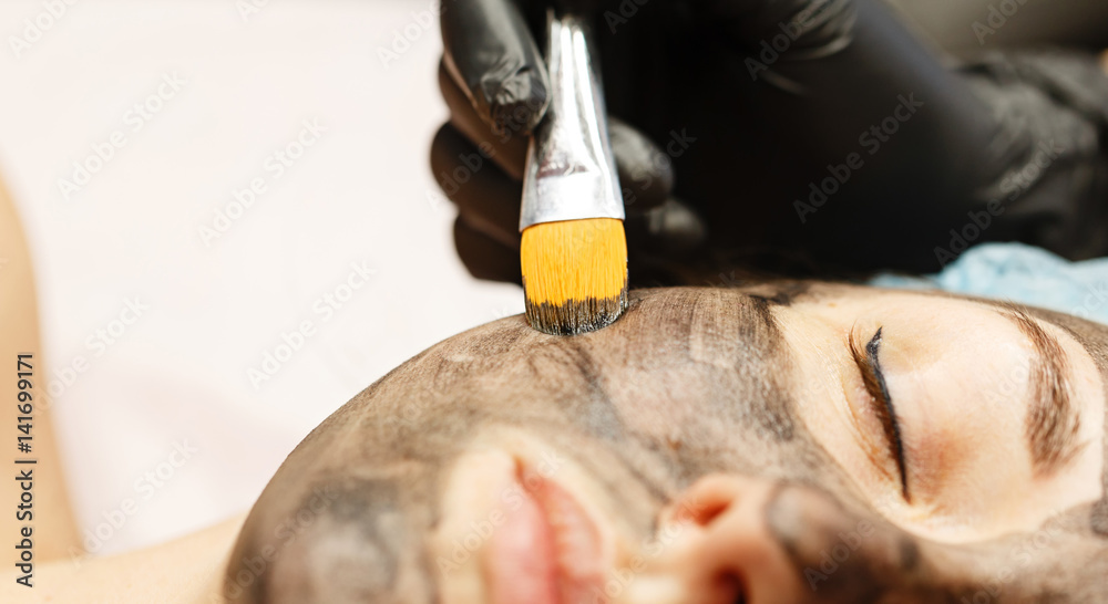 The cosmetologist applies the carbon nanogel to the skin of the client's face. Preparation for laser treatment of the skin. Carbon face peeling.