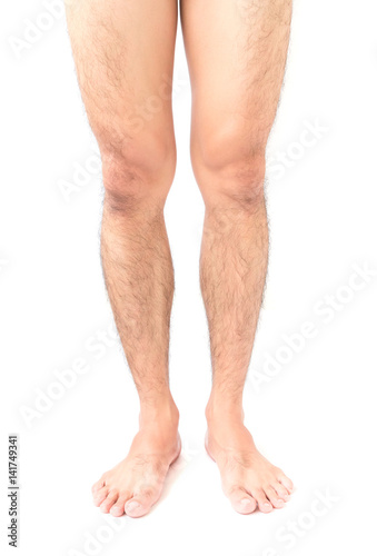 Closeup legs men skin and hairy with white background, health care and medical concept