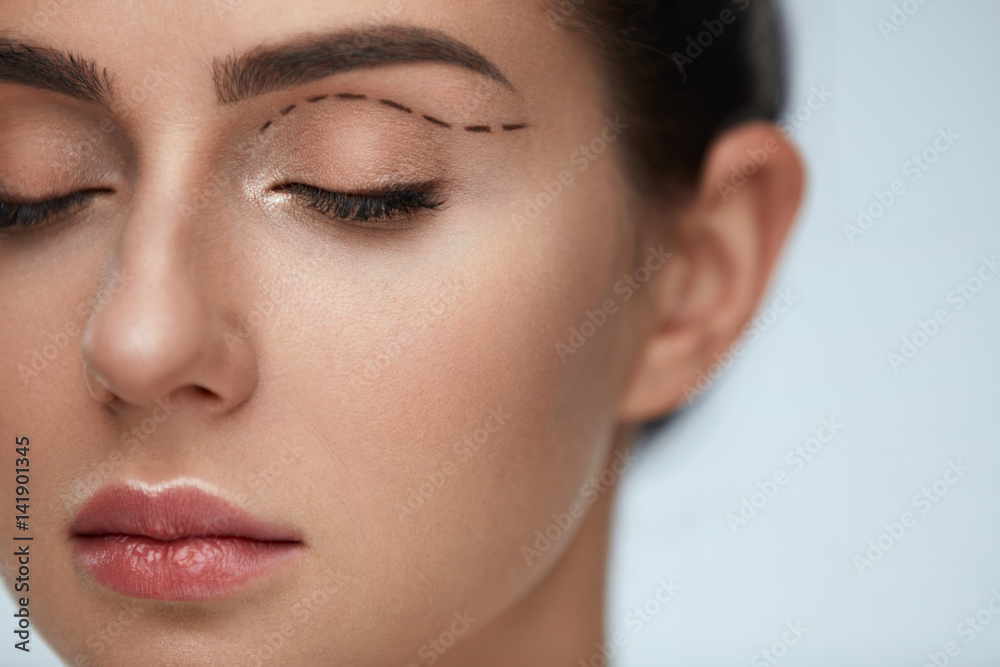 Plastic Surgery Operation. Woman Face With Black Surgical Lines Plastic Surgery Operation. Woman Face With Black Surgical Lines