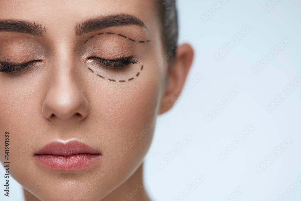 Plastic Surgery Operation. Woman Face With Black Surgical Lines Plastic Surgery Operation. Woman Face With Black Surgical Lines