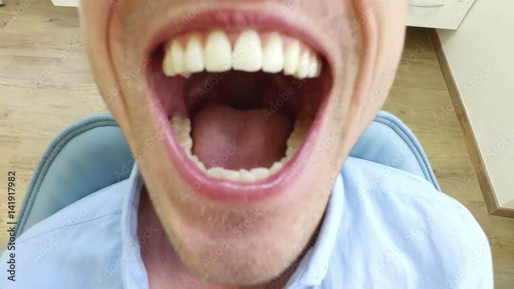 Close up of beautiful little girl sitting in the dental chair with open mouth