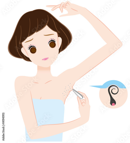 毛抜きでムダ毛処理　埋没毛