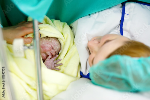 Mother looking for first ime her baby being born via Caesarean Section photo