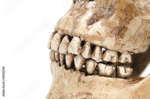 model of human teeth (skull) on a white background