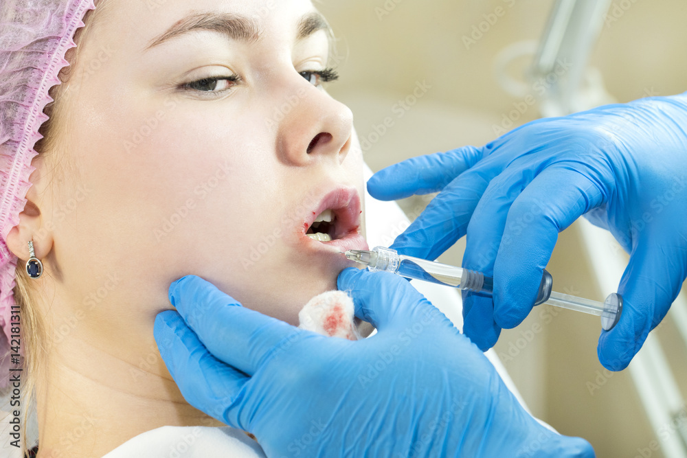 The process of cosmetic surgery of water injection in the area of the lips of a woman The process of cosmetic surgery of water injection in the area of the lips of a woman