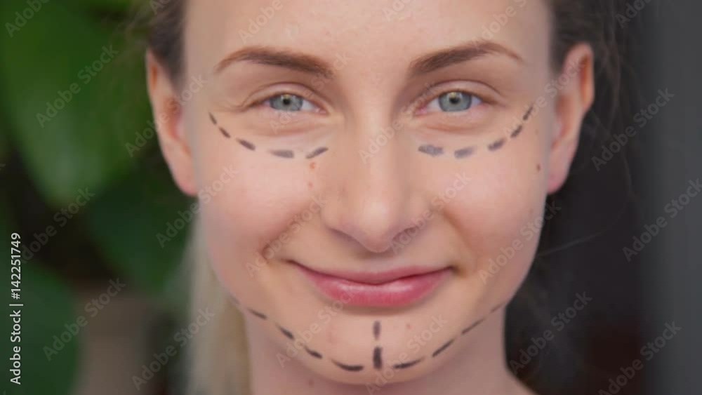 Plastic surgeon marking woman face. Plastic surgeon marking woman face.