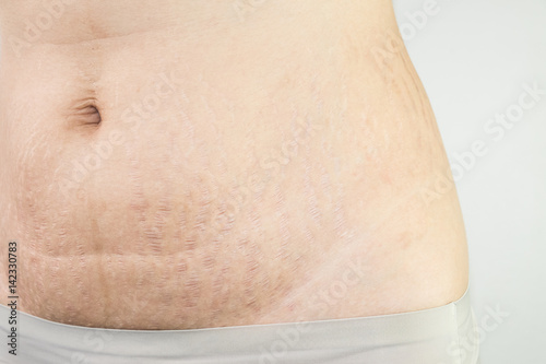 woman with Belly pattern