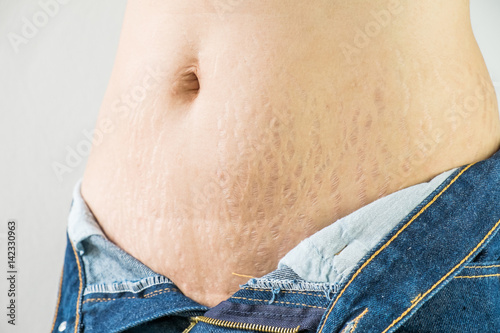 woman with Belly pattern blue jeans 