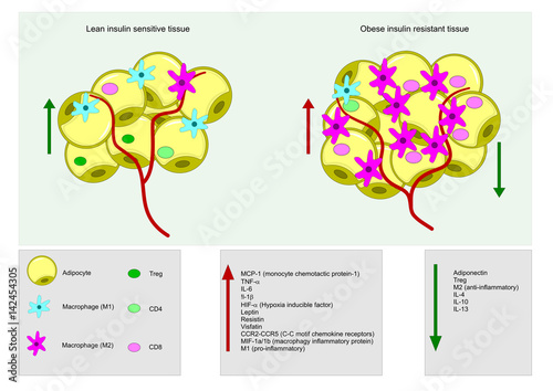 obesity and inflammation