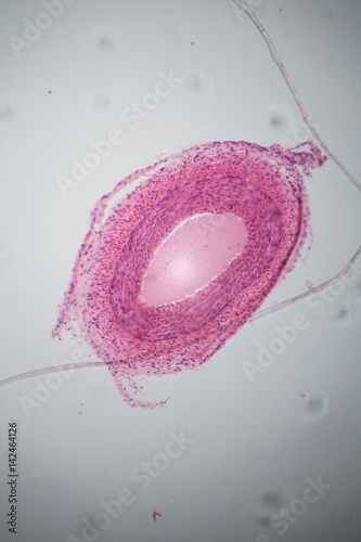 Vein section under the microscope photo