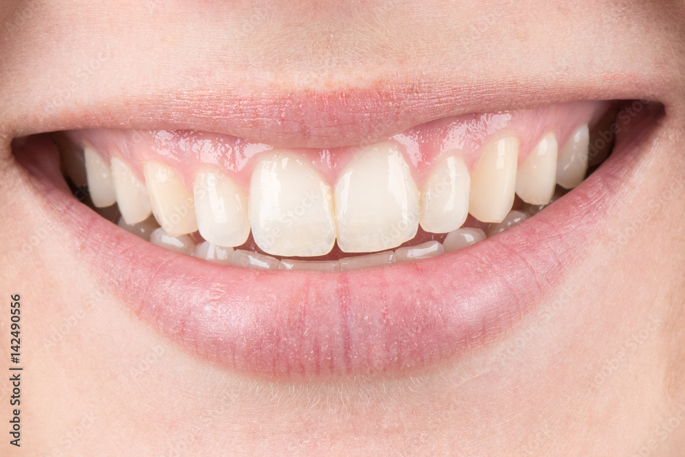 Fototapeta premium Close up of a beautiful smile 