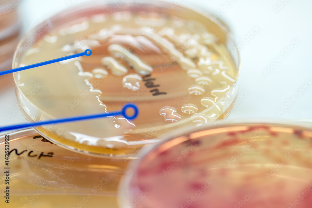 Bacterial culture growth on MacConkey agar (Gram Negative Bacilli