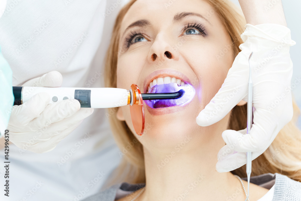 Close-up partial view of dentist using dental curing UV lamp on teeth of patient Close-up partial view of dentist using dental curing UV lamp on teeth of patient