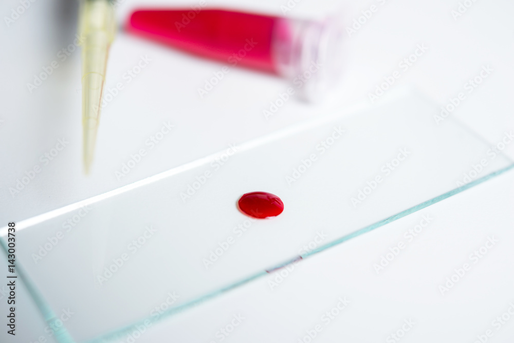 A drop of blood for research and analysis A drop of blood for research and analysis