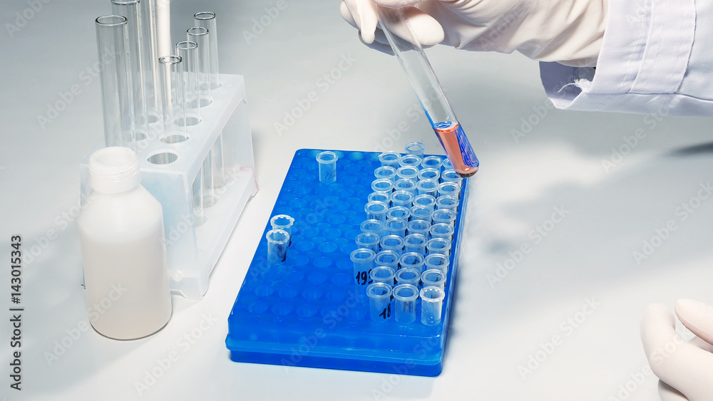 Lab technician scientist performs medical clinic chemical analysis and diagnostics using test tube phial and pipette. Lab technician scientist performs medical clinic chemical analysis and diagnostics using test tube phial and pipette.