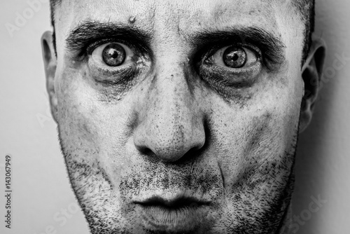 Ugly man portrait with unshaven face, dirty skin, big nose with black spots, terrific big eyes, murderer face