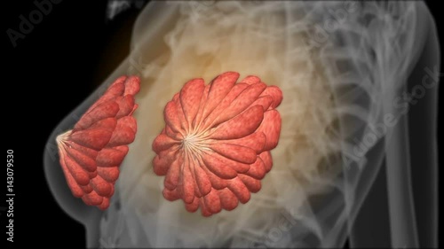 X-ray of the female breasts. Mammogram