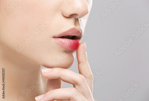 Принти на полотні Woman with cold sore touching lips on light background