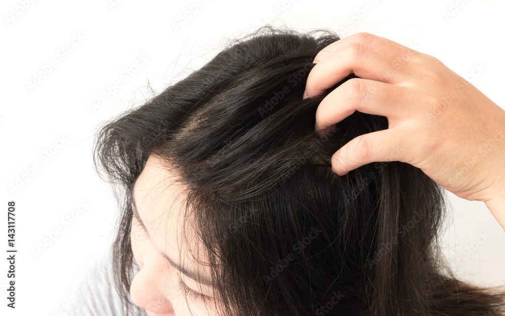 Closeup woman hand itchy scalp, Hair care concept Closeup woman hand itchy scalp, Hair care concept