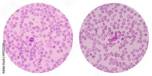 Obraz na plátně red blood cells on white background medical science.