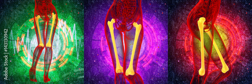 3d rendering medical illustration of the femur bone photo