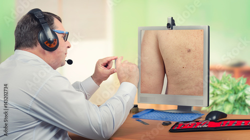Telemedicine dermatologist examines sebaceous cyst on monitor