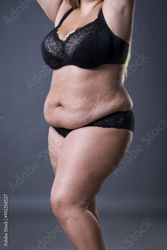 Woman with fat abdomen, overweight female stomach, stretch marks on belly
